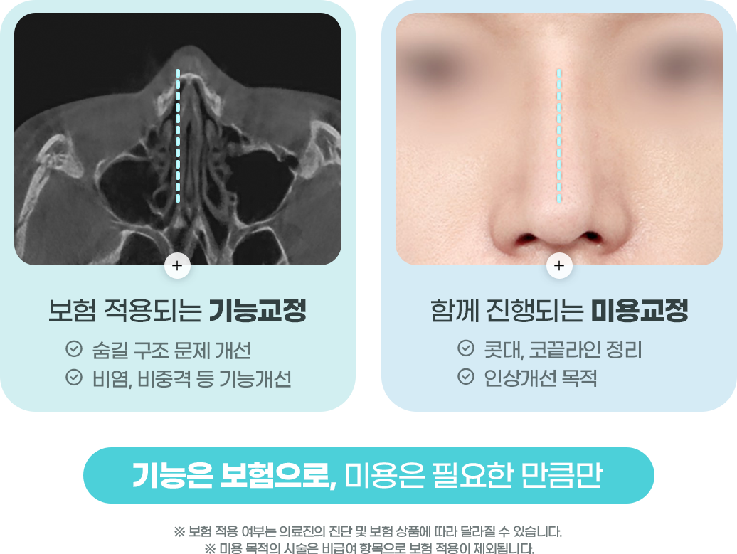 비염코보험적용기준 사진