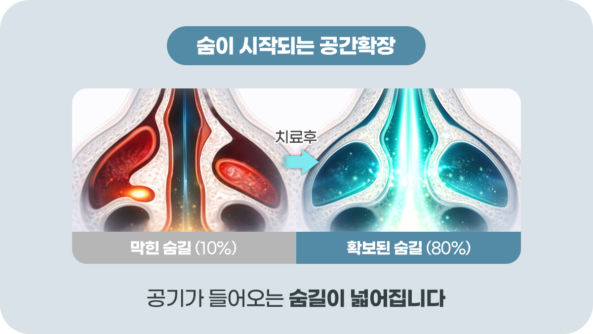 Before&After이미지