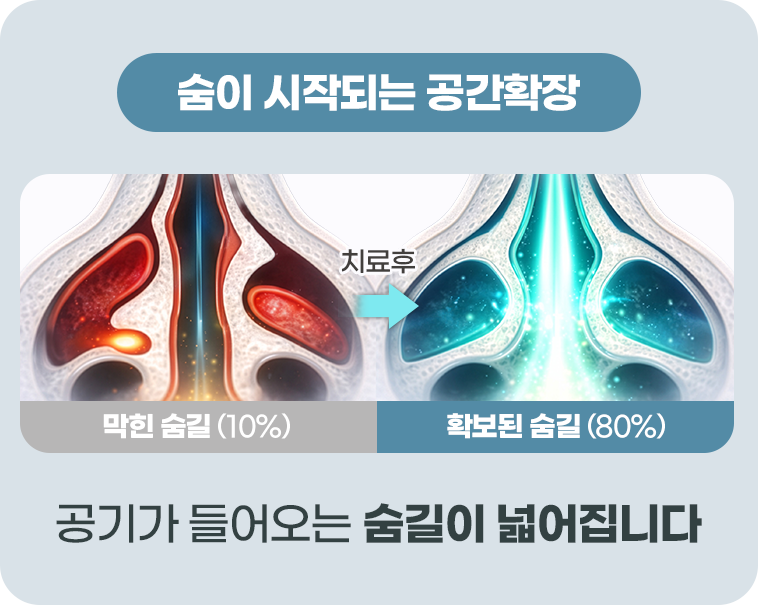 Before&After이미지