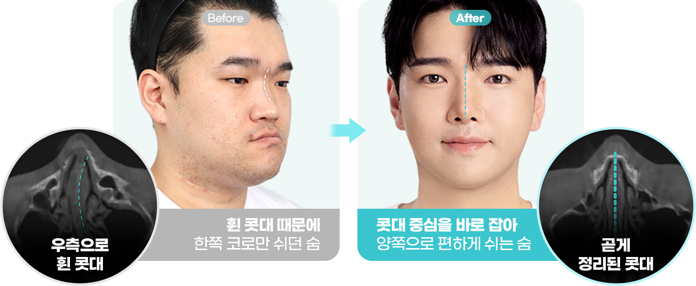 Before&After이미지