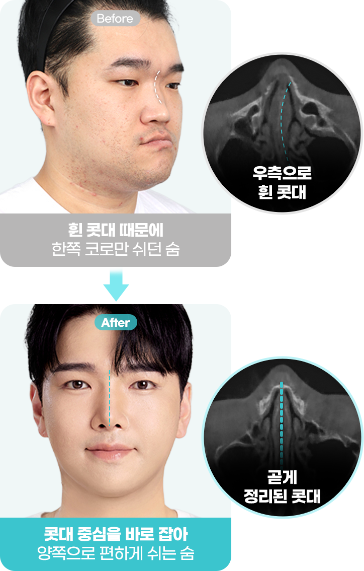 Before&After이미지
