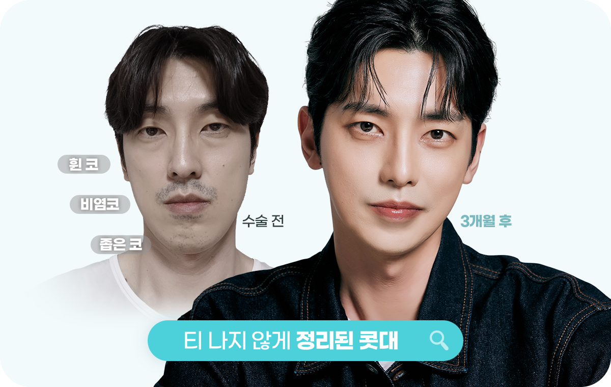 티나지 않게 정리된 콧대