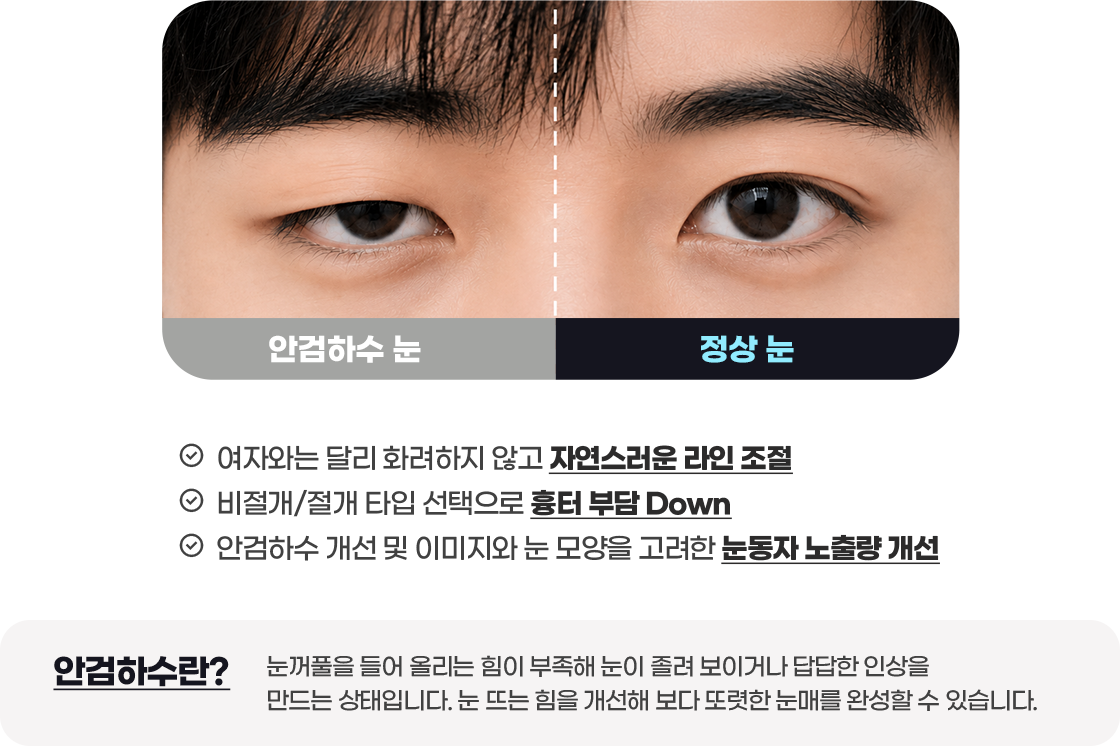 DA 남자성형
