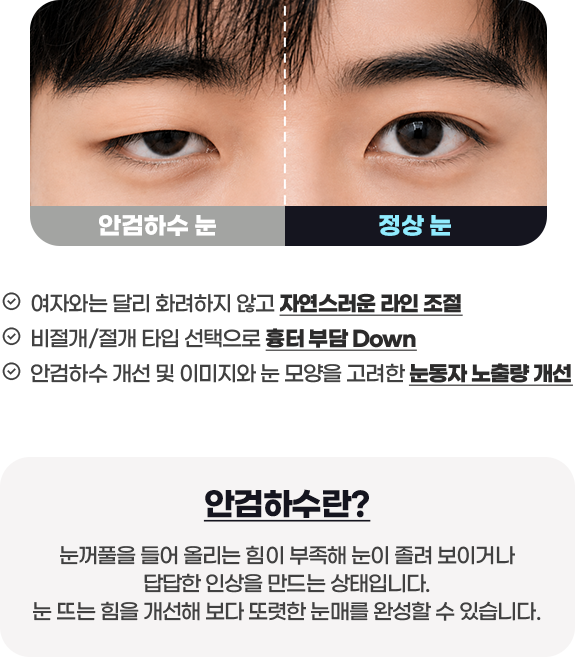 DA 남자성형