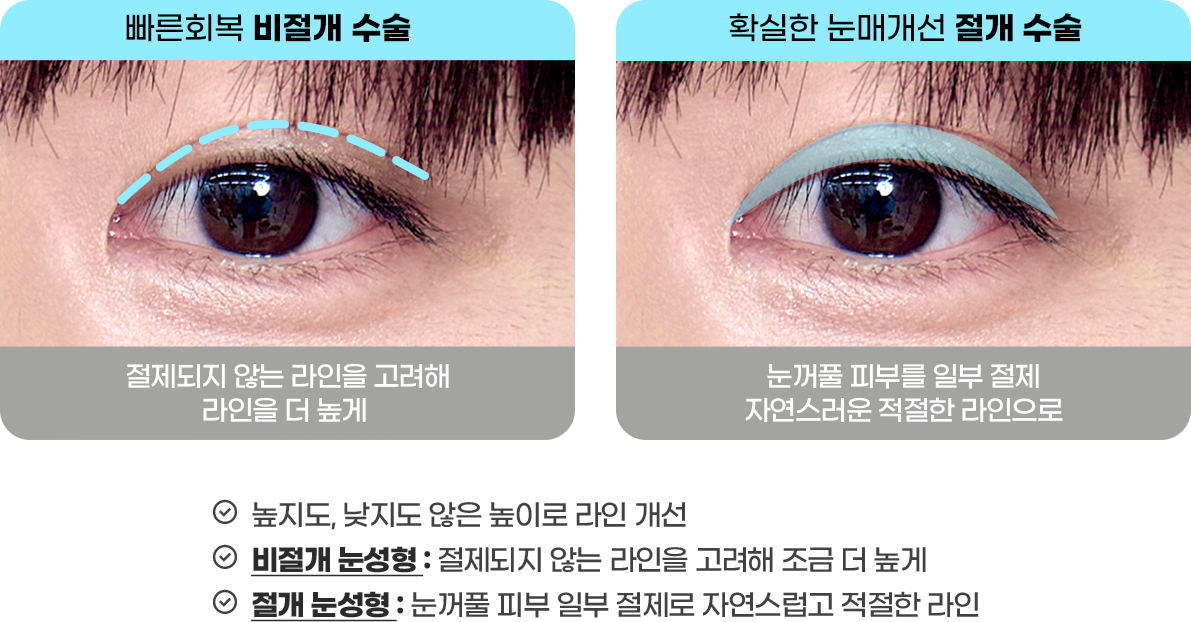 DA 남자성형
