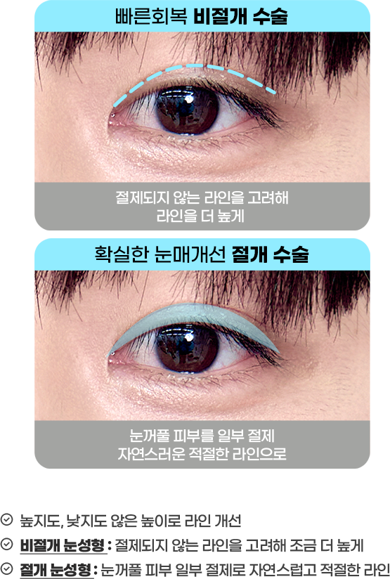 DA 남자성형