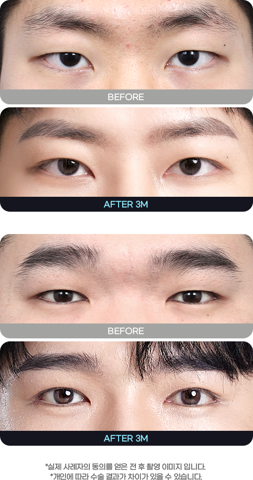 DA 남자성형