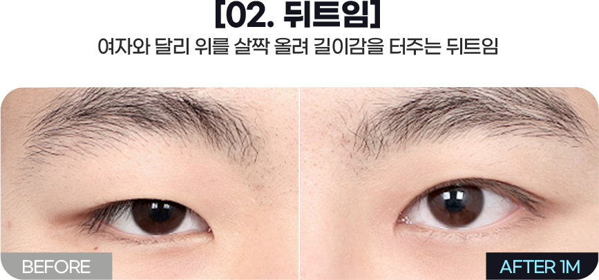 DA 남자성형