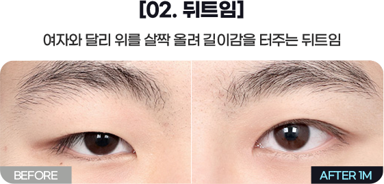 DA 남자성형
