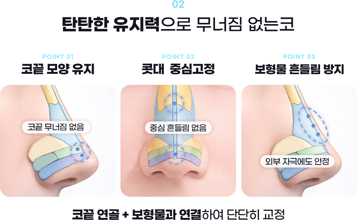 DA 남자성형