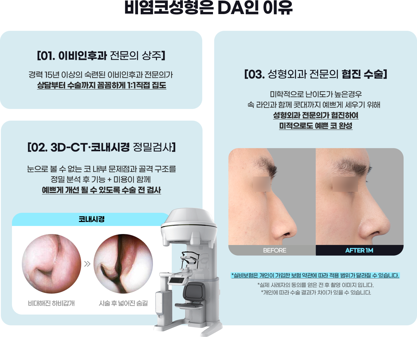 DA 남자성형