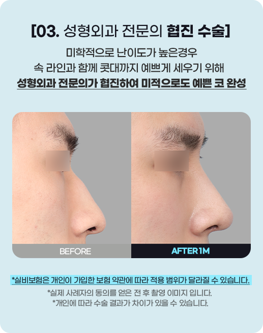 DA 남자성형