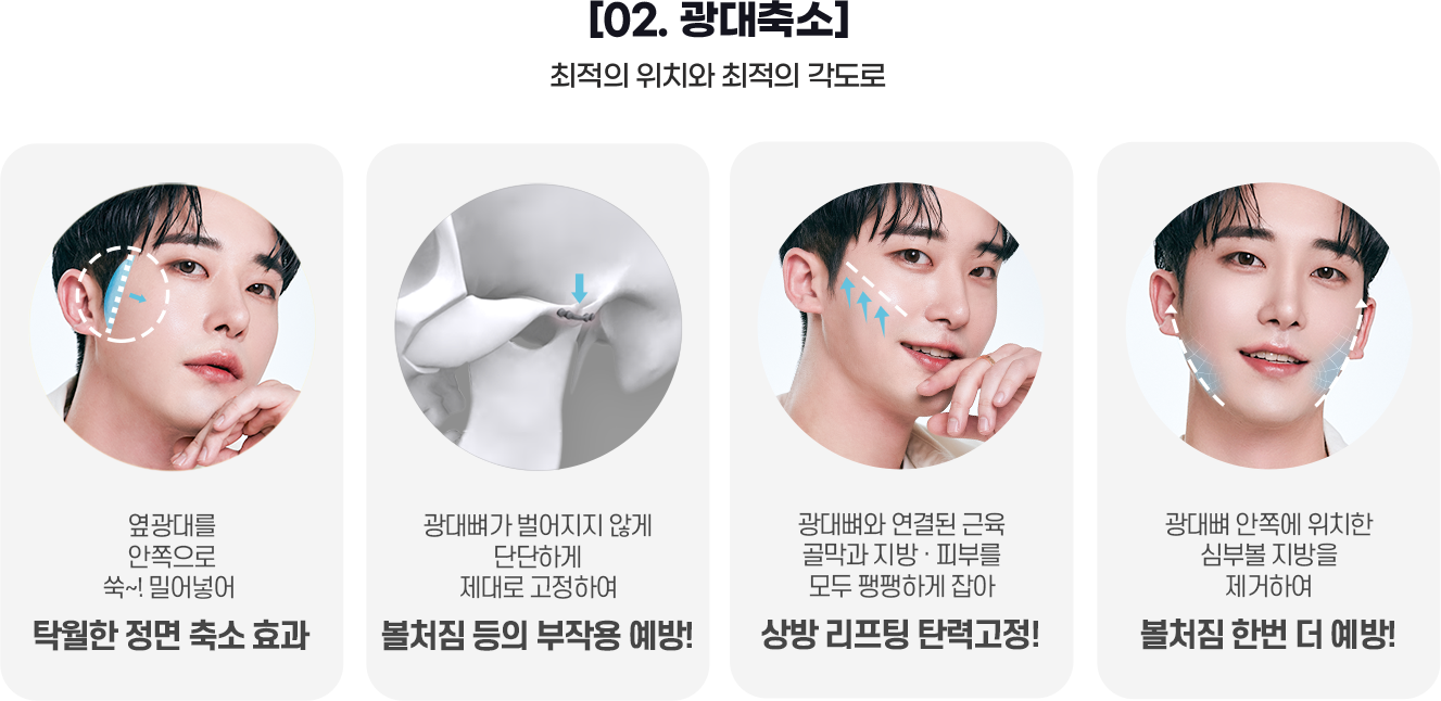 DA 남자성형