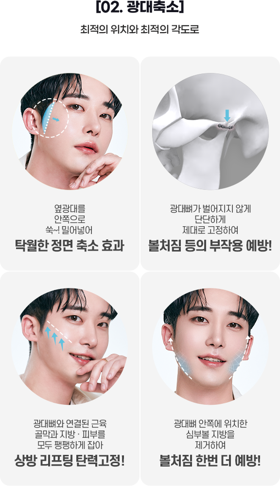DA 남자성형
