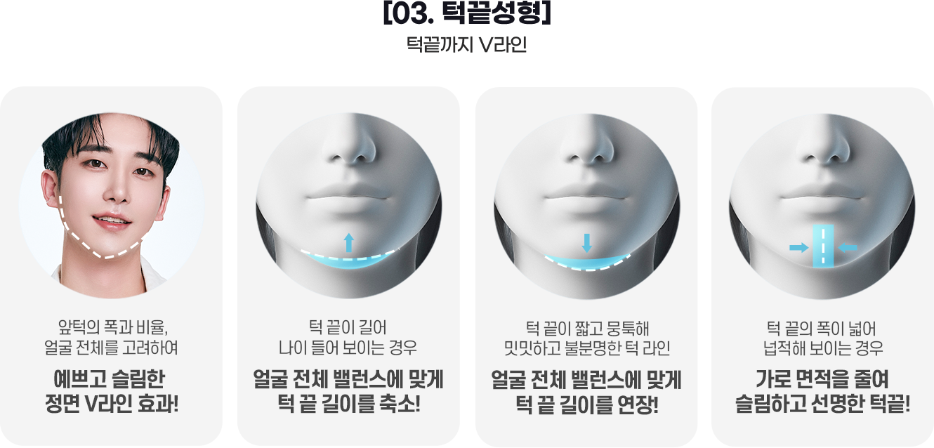 DA 남자성형