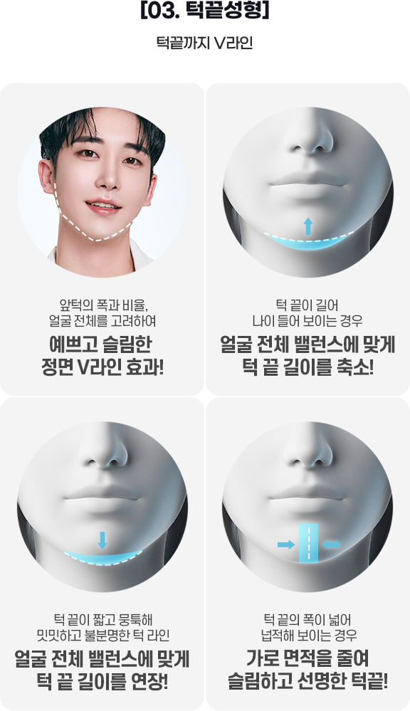 DA 남자성형