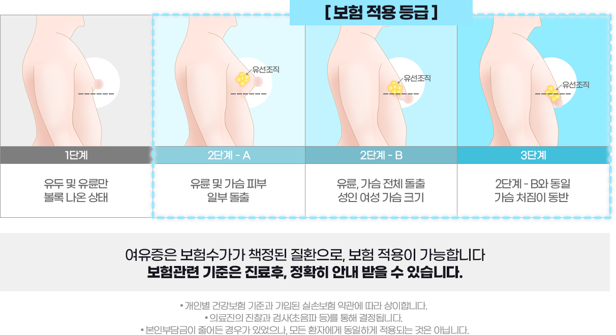 DA 남자성형