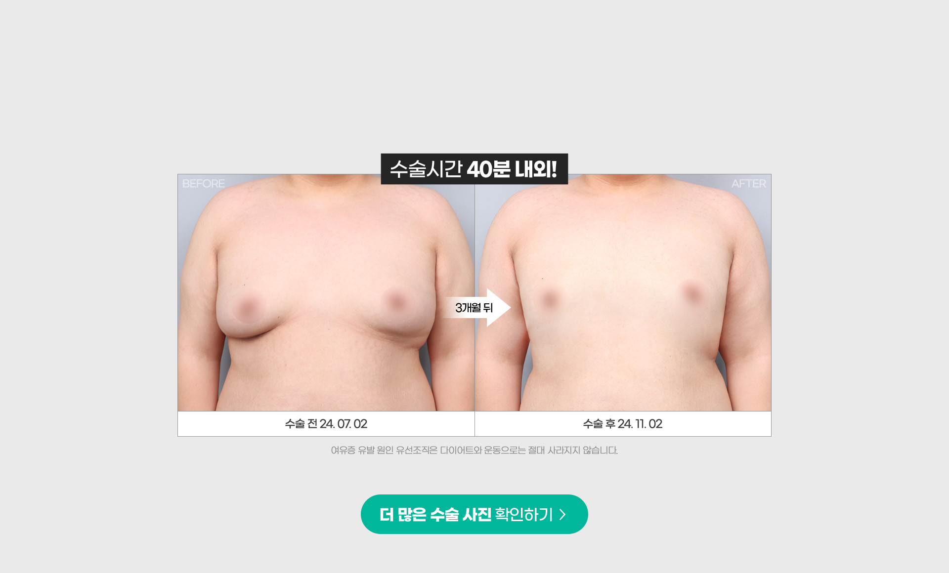 40분수술, 오늘부터 자신감!