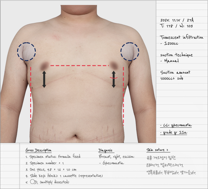 가슴노트 실제 사례