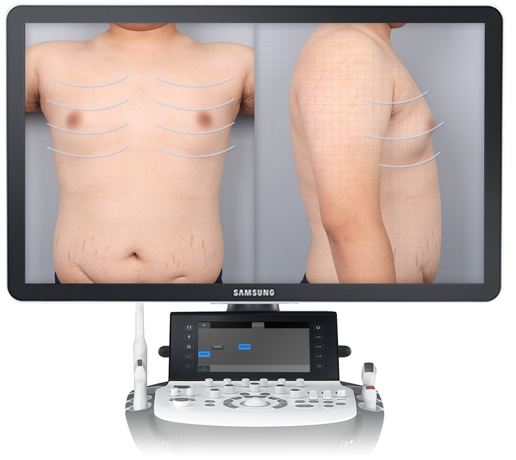 가슴 분석 모니터링