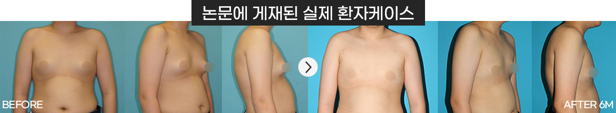 실제 환자 케이스