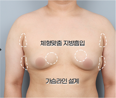 남자다운 가슴 설계