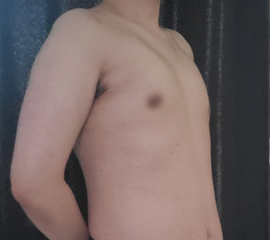 에프터 이미지