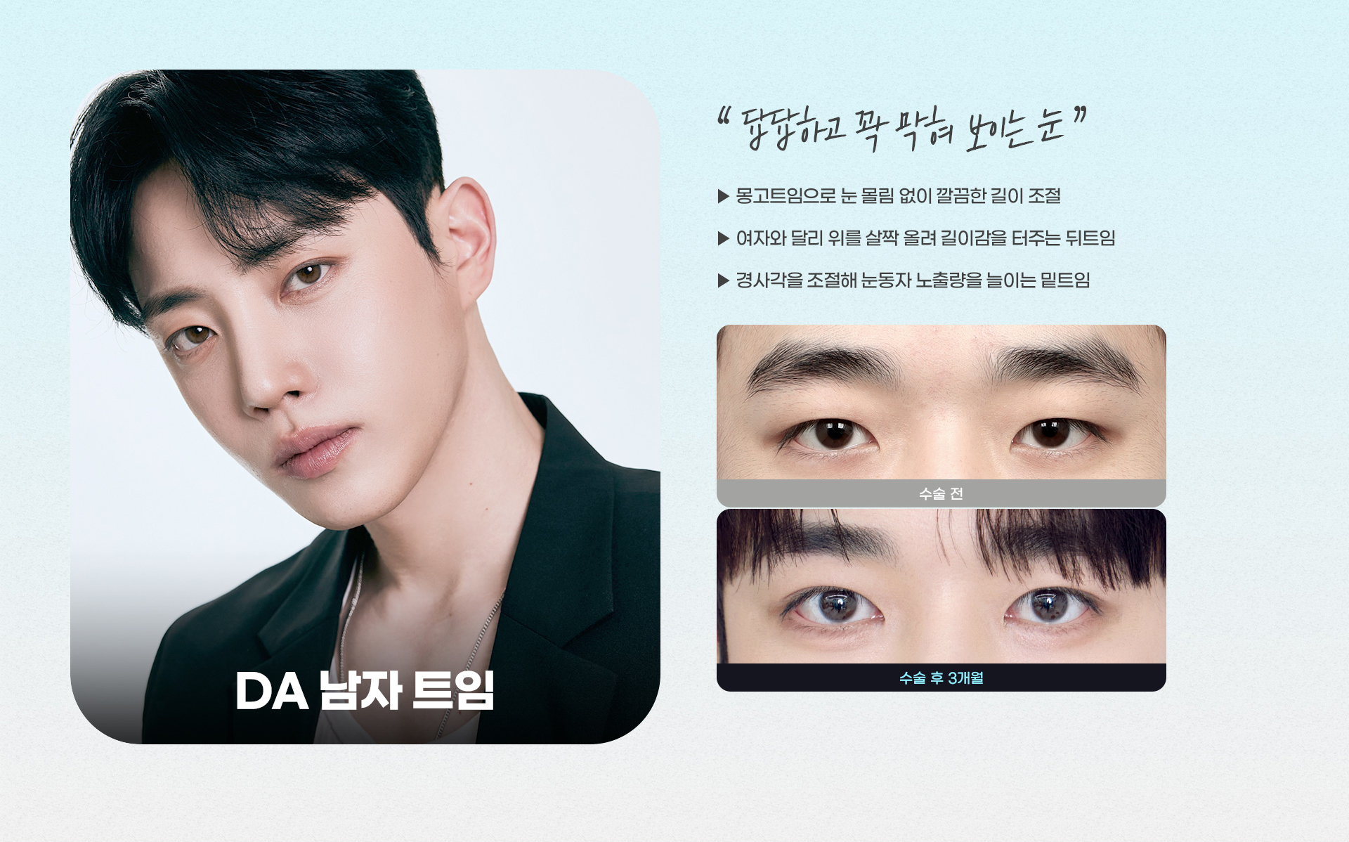 DA 남자 트임