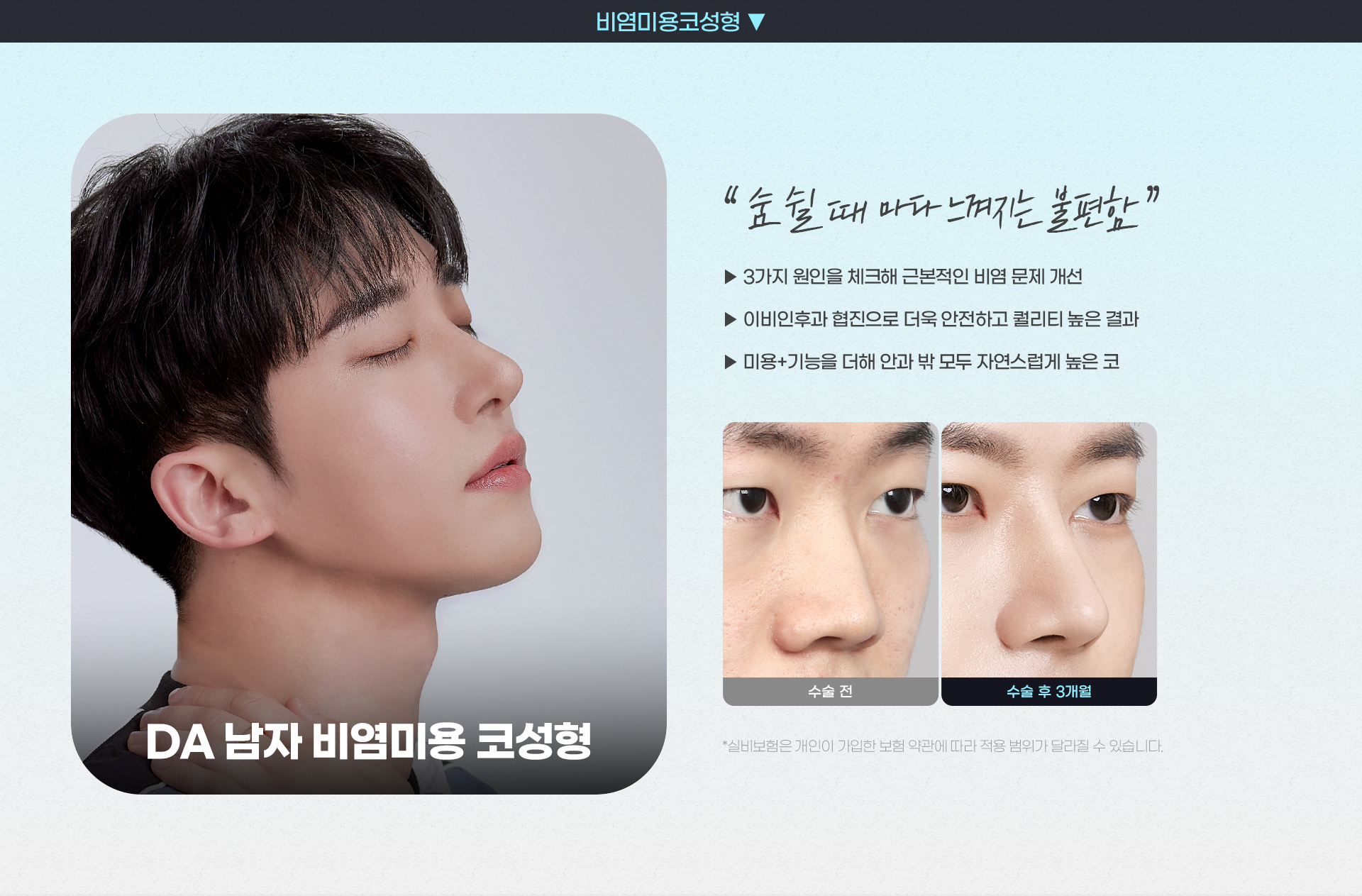 DA 남자 비염미용 코성형