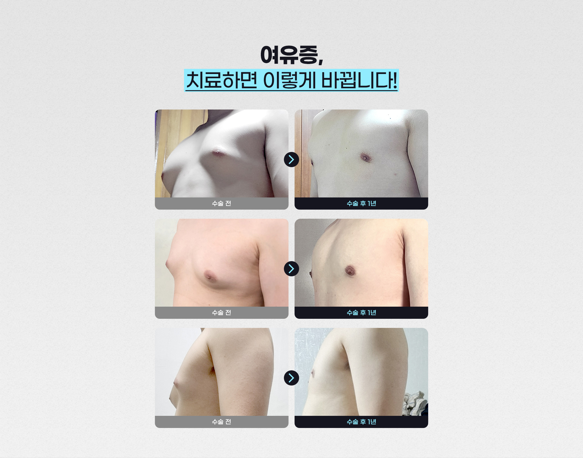 올 여름  당당하게 반팔입자! 