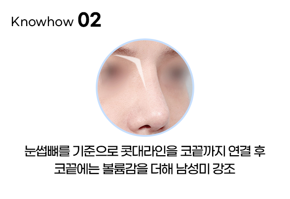 디에이 비염미용코성형