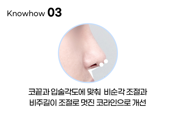 디에이 비염미용코성형