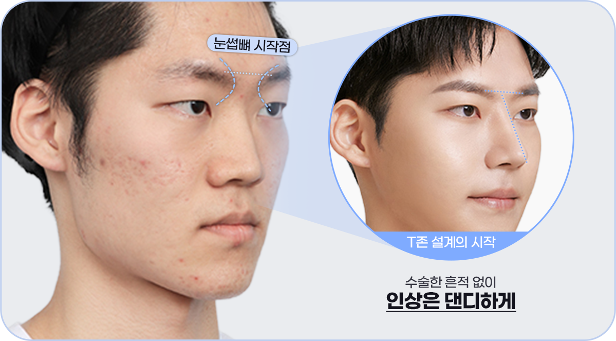 수술한 흔적 없이 인상은 댄디하게