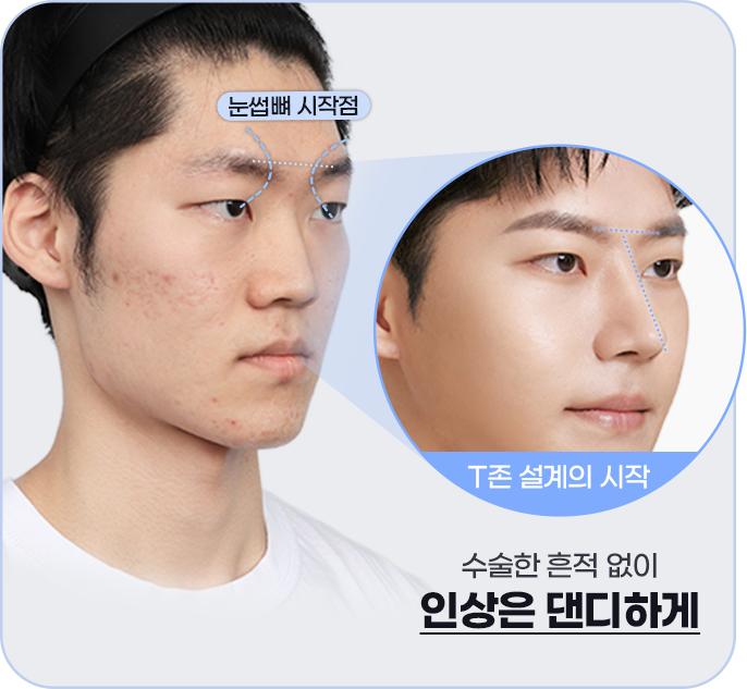 수술한 흔적 없이 인상은 댄디하게