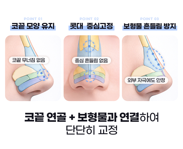 코끝모양, 콧대 중심고정, 보형물 흔들림 방지