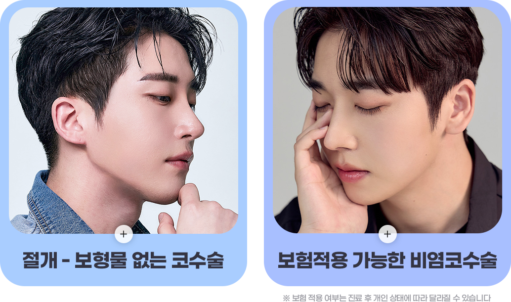 디에이 남자 코성형 전