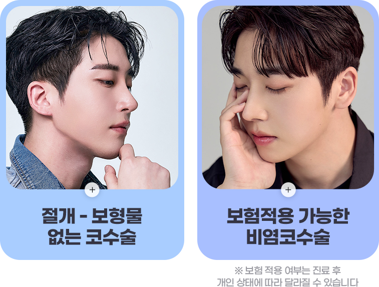 디에이 남자 코성형 전