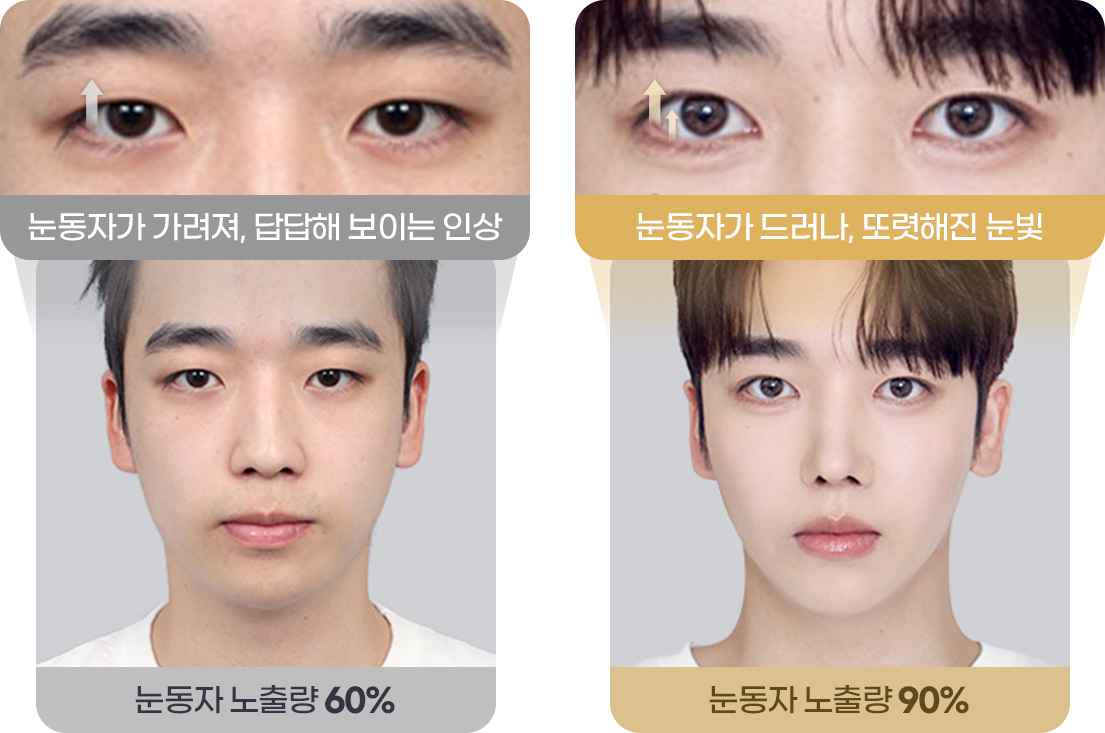 눈동자 노출량 60%