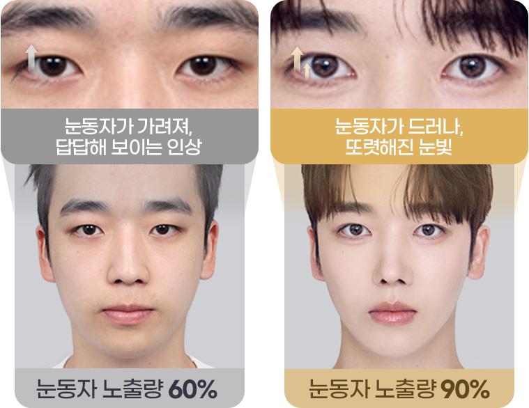 눈동자 노출량 90%