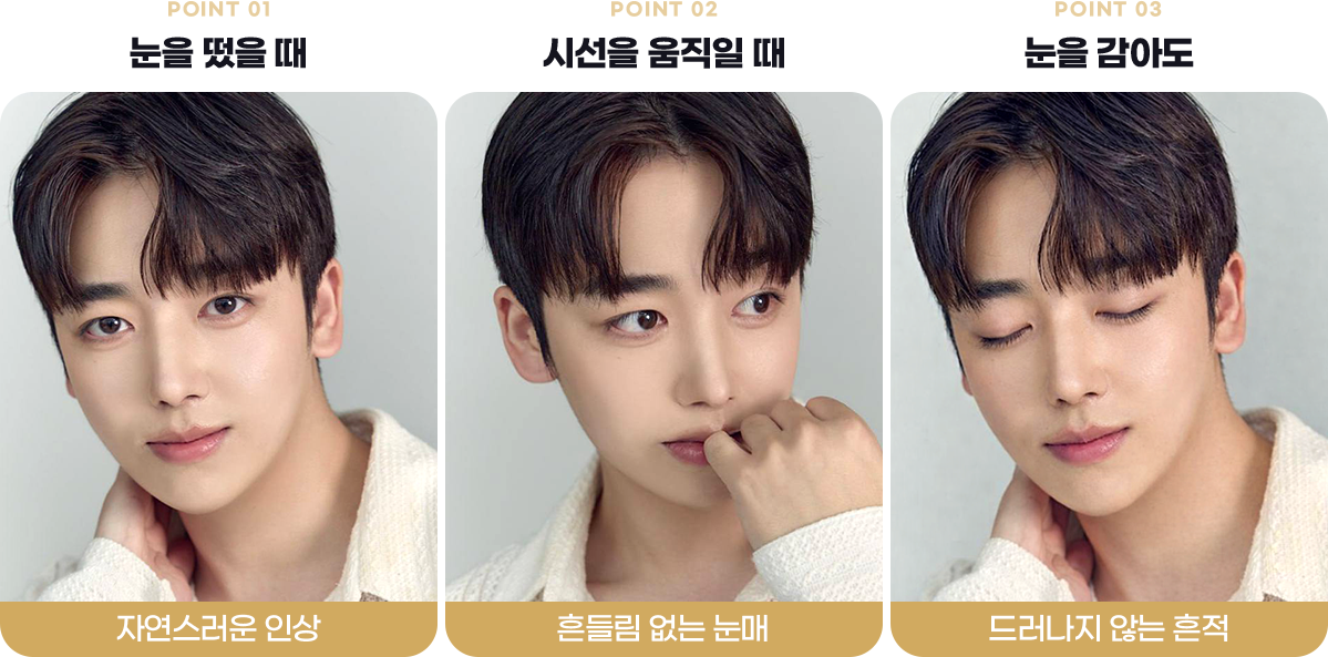 눈매교정후 사진