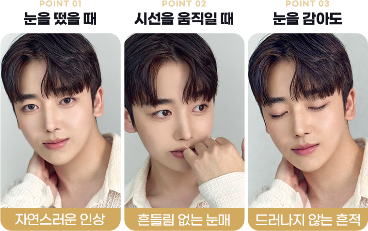 눈매교정후 사진