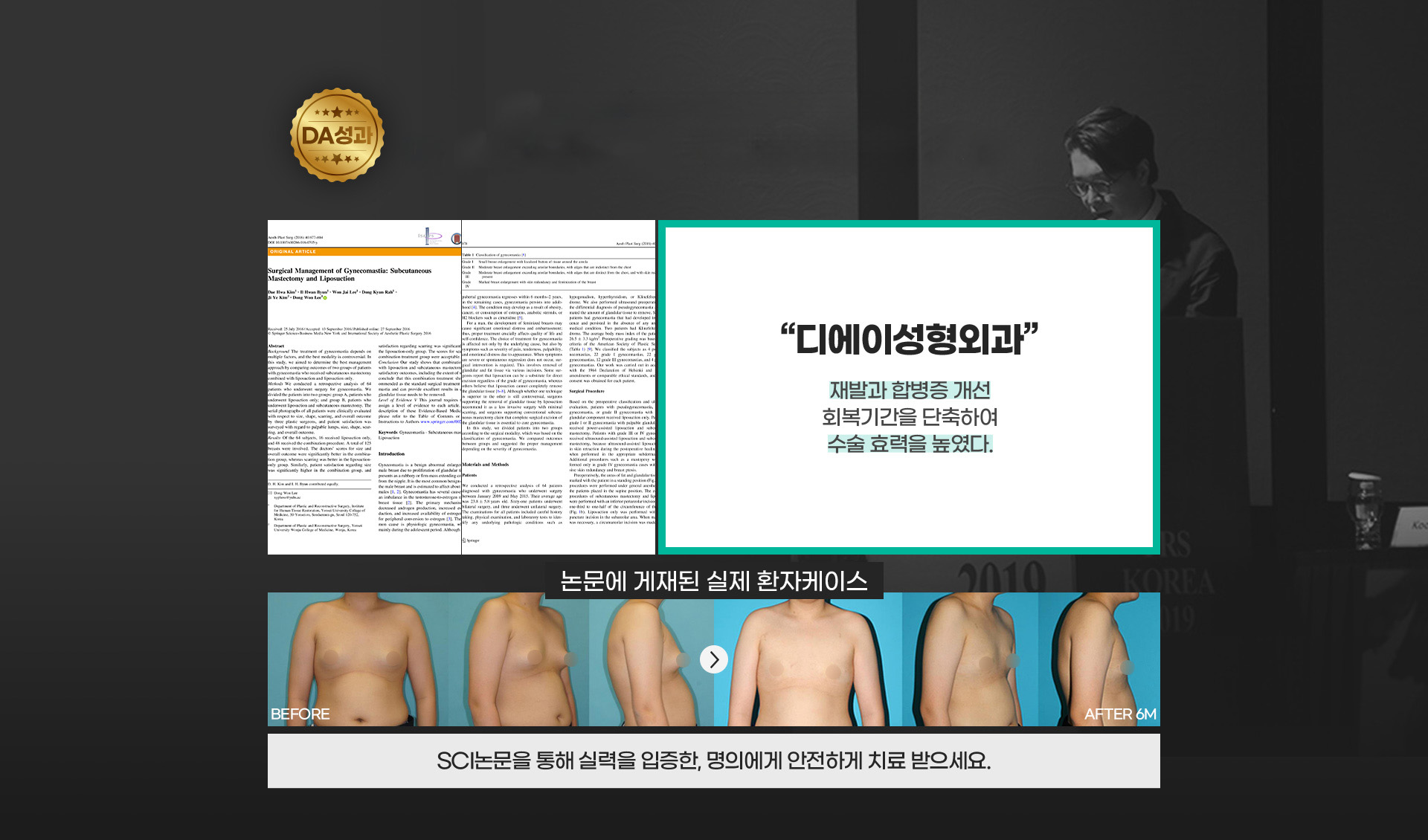 국제 미용성형외과학회 공식 논문 채택 여성형유방증, 표준치료로 권장