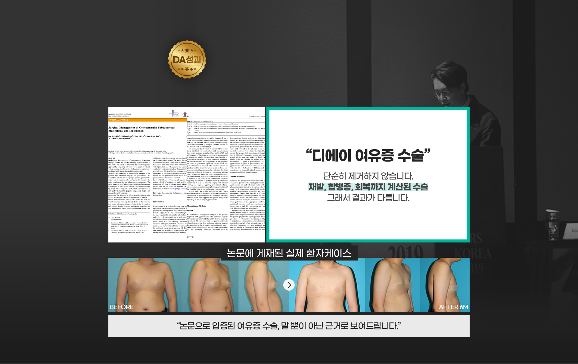 국제외과학회 공식논문 채택 환자의 회복까지 논문으로 검증한 수술