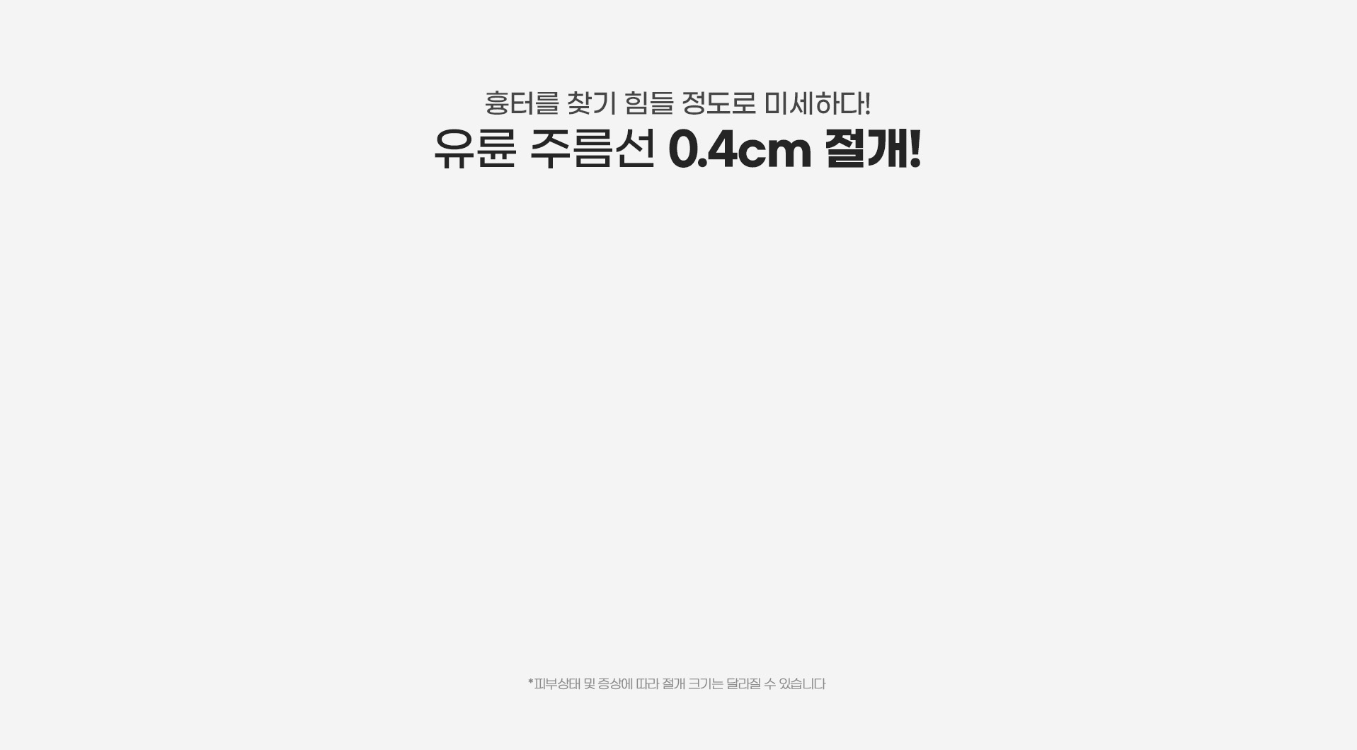 흉터를 찾기 힘들 정도로 미세하다! 유륜 주름선 0.4cm 절개법!