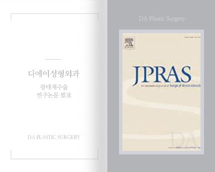 [논문발표] 이상우 원장, 'Revision Peduction Malaplasty with Coronal Approach' 연구 논문 발표